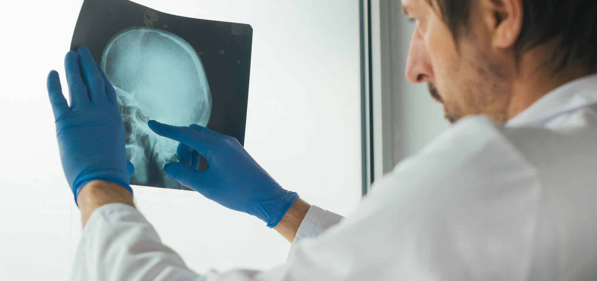 A doctor looking at an x ray of a skull